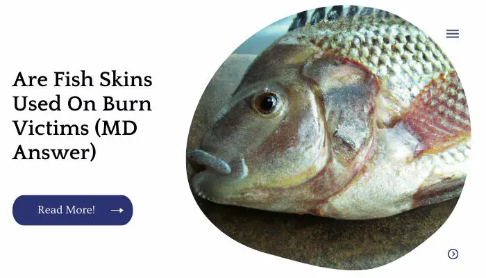 Are Fish Skins Used On Burn Victims (MD Answer)